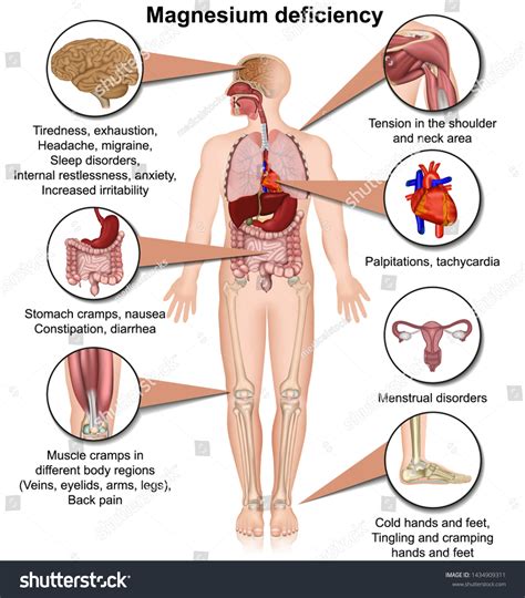 561 Magnesium Deficiency Images, Stock Photos & Vectors | Shutterstock