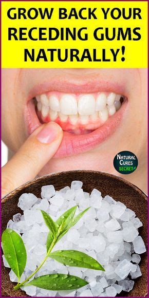 Home Remedies For Gum Disease - Healthy Lifestyle