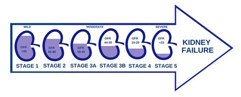 Stages of Kidney Disease, Dallas Nephrology Associates