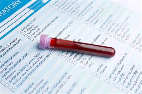 Urea and Electrolytes Blood Test - Medquit