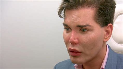 Botched Patient Rodrigo Learns His Nose Could ''Fall Off'' | E! News