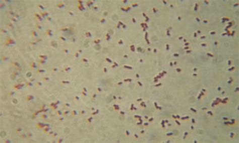 Enterobacter Aerogenes Gram Stain