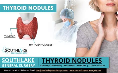 thyroid nodules diagnosis Archives - Southlake General Surgery