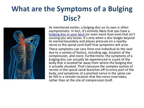 Managing Symptoms from a Bulging Disc in Your Back