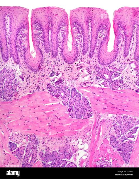 Papillae taste buds, human tongue, bright field photomicrograph ...