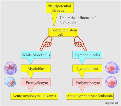 Acute Leukemias and their Diagnosis, Acute Myelocytic and Acute ...