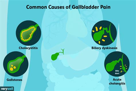 What Causes Gallbladder Pain?