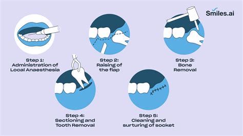 When Can I Use Straws After Tooth Extraction at Joe Long blog