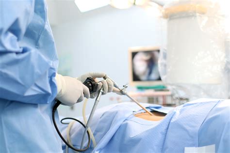 Frequently Asked Questions About Myomectomy Surgery - Facty Health