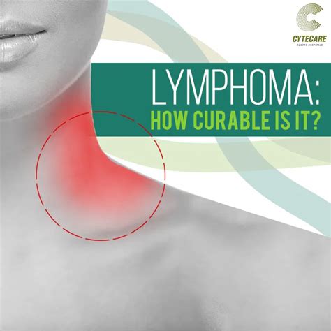 Non Hodgkin's Lymphoma Survival Rate By Age - Non Hodgkin Lymphoma In ...