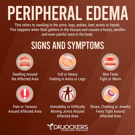 Edema: Symptoms, Causes, and Natural Support Strategies