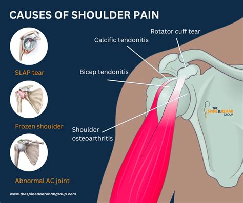 Chronic Shoulder Pain Causes And Treatments – Themelower