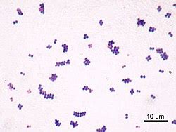 Staphylococcus aureus - Wikipedia