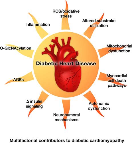 Basic Mechanisms of Diabetic Heart Disease | Circulation Research