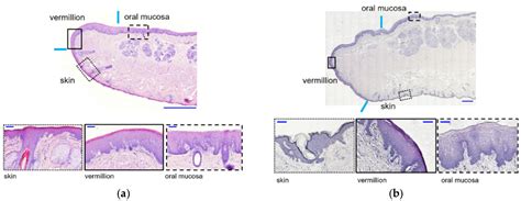 Histological Structure Of Lips | Lipstutorial.org