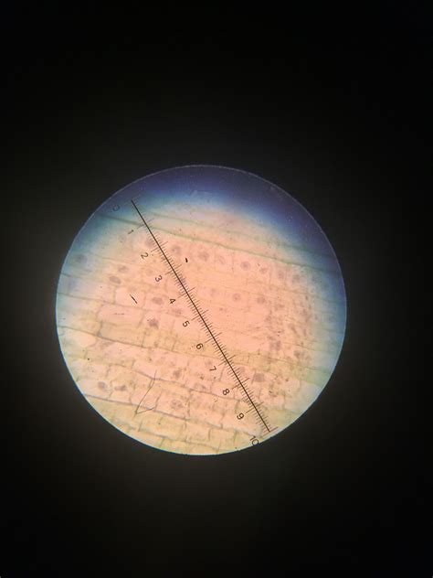 Root hair cells under a light microscope | Biology, A level biology ...