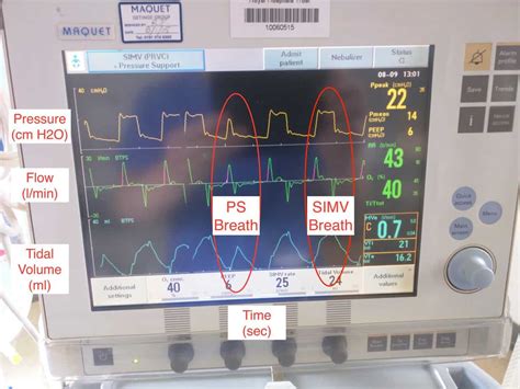 Setting up the Ventilator | Paediatric Emergencies