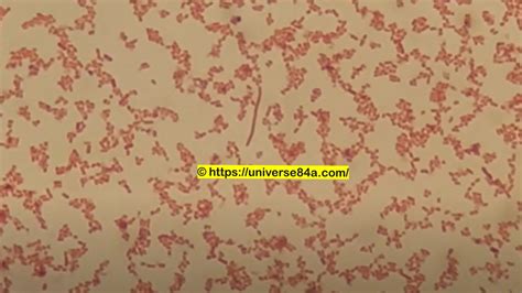 Enterobacter Aerogenes Gram Stain