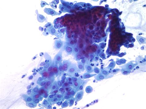 Uterine Cervix Cytopathology Cellnetpathology