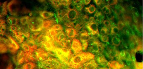 Liver Cells Created From Patients’ Skin Cells University Of Cambridge