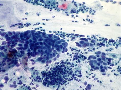 Uterine Cervix Cytopathology Cellnetpathology