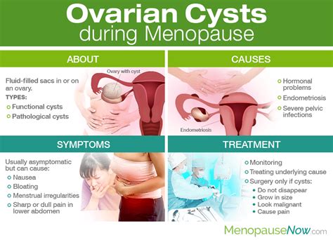 ovarian cysts during menopause menopause now