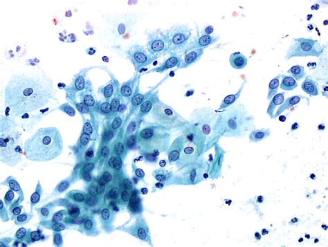 Cytopathology Of The Uterine Cervix Digital Atlas