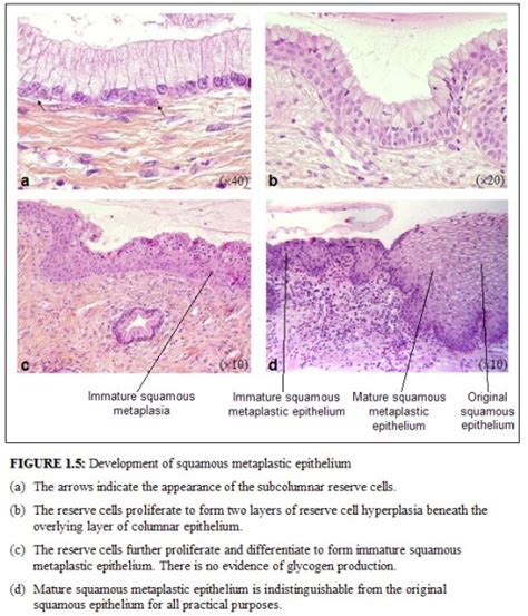 Anatomical And Pathological Basis Of Visual Inspection