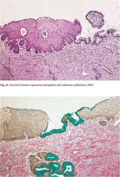 Descending Repair Figs 1927 Cell Differentiation