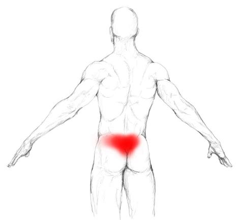 gluteus medius schmerzen und triggerpunkte selbst behandeln