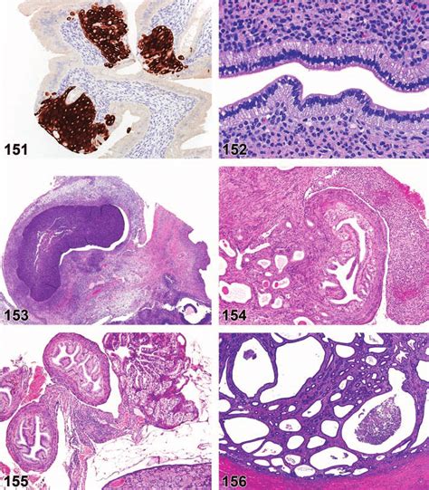 Squamous Metaplasia Uterus Anti Cytokeratin 14 Rat