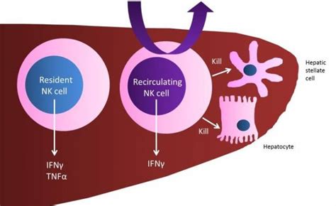 Liver Nk Cells In Non Alocholic Fatty Liver Disease Institute Of