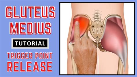 trigger point release gluteus medius youtube