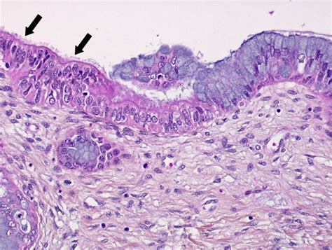 Histopathology Of The Uterine Cervix Digital Atlas