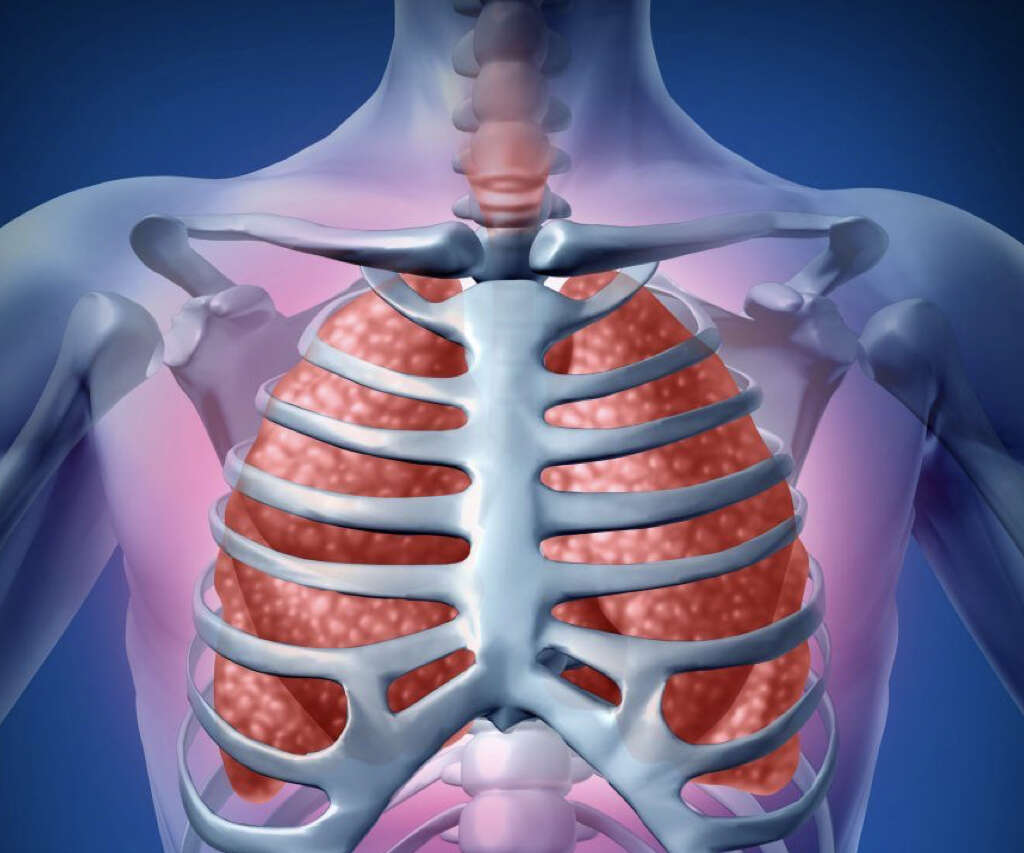 Aspiration Pneumonia