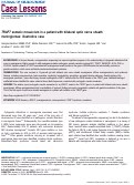 Cover page: TRAF7 somatic mosaicism in a patient with bilateral optic nerve sheath meningiomas: illustrative case