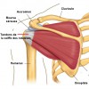 Douleur muscle omoplate