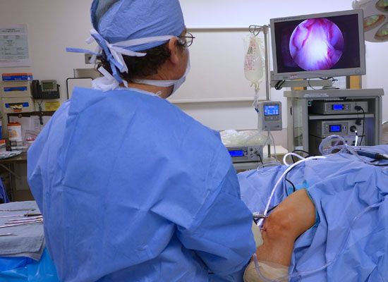 knee arthroscopy OR