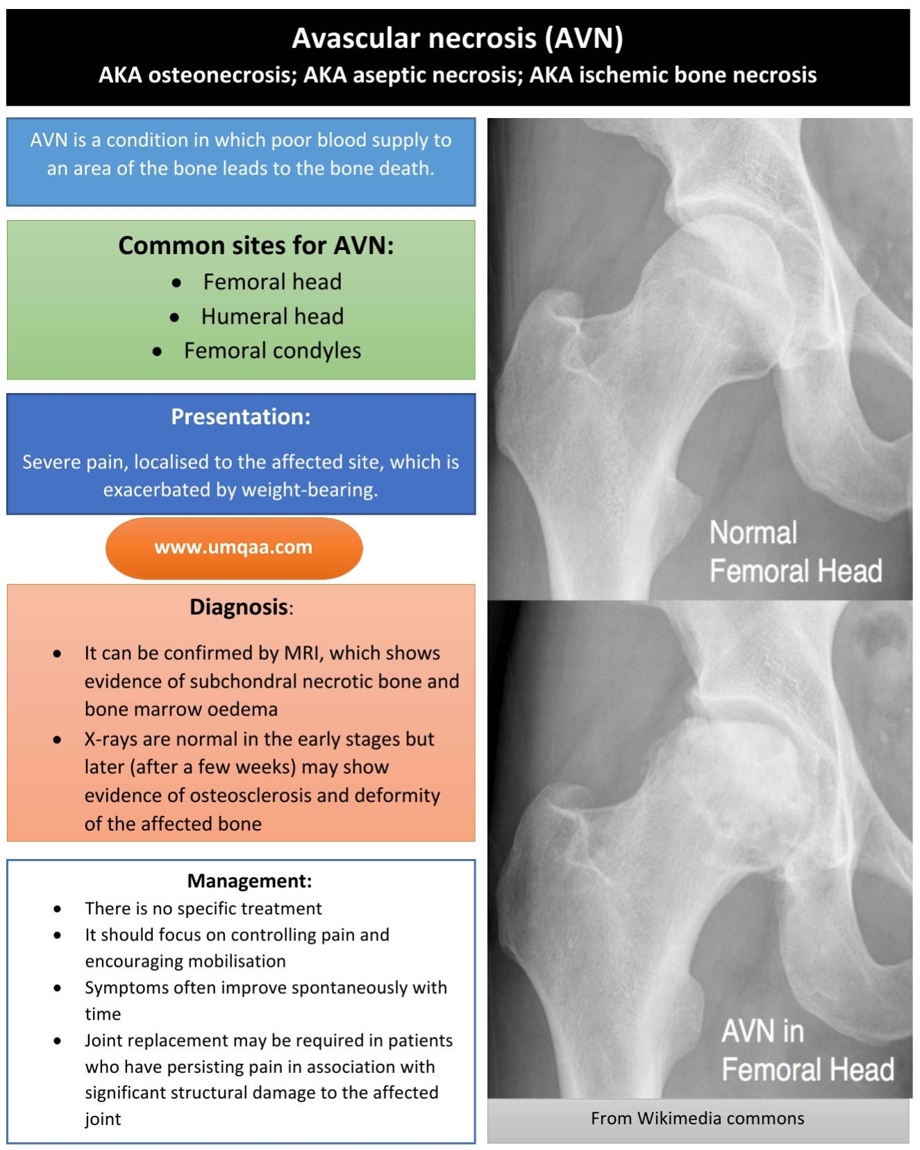 What Is Avascular Necrosis Of The Femoral Head With Pictures | The Best ...