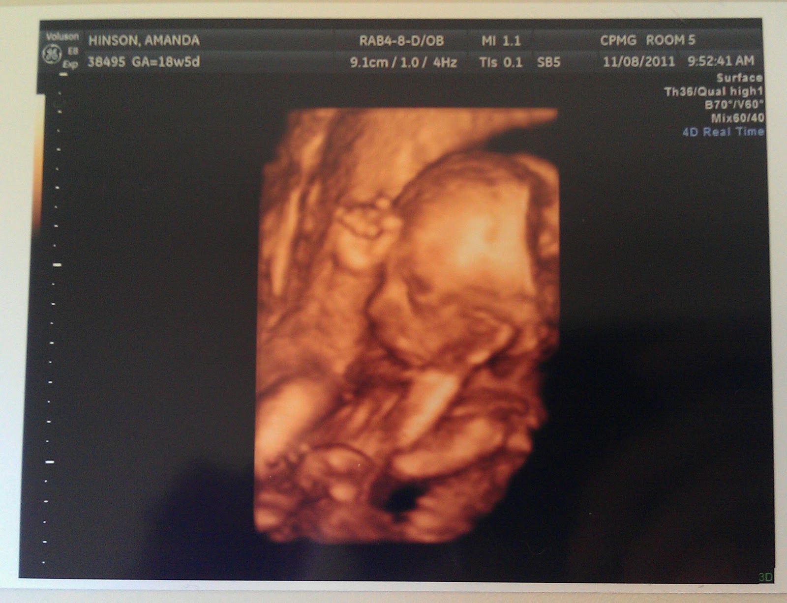 24 weeks pregnant 4d ultrasound - managelopers