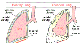 What Is Mesothelium: Mesothelium