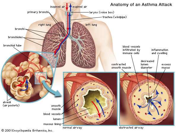 Dr. Saif ALaa ALqaisy: common pathologies of the respiratory tract in ...