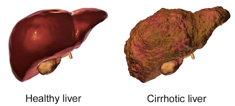 LIVER: function of a liver, harmful factors, symptoms, liver Diseases ...