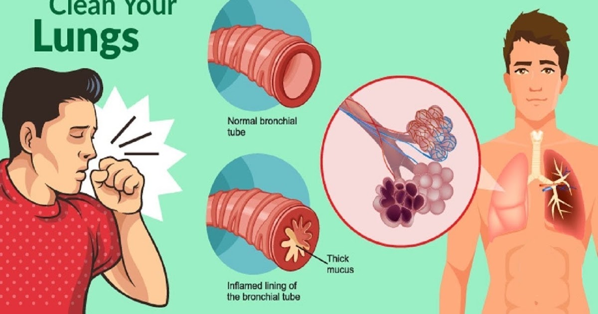 Get Rid of Phlegm and Mucus in Chest & Throat Instantly - Health Cares