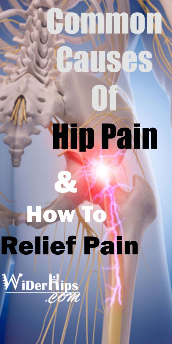 How To Unlock Hip Flexor: Causes of Hip Pain in Ladies Hip pain treatment