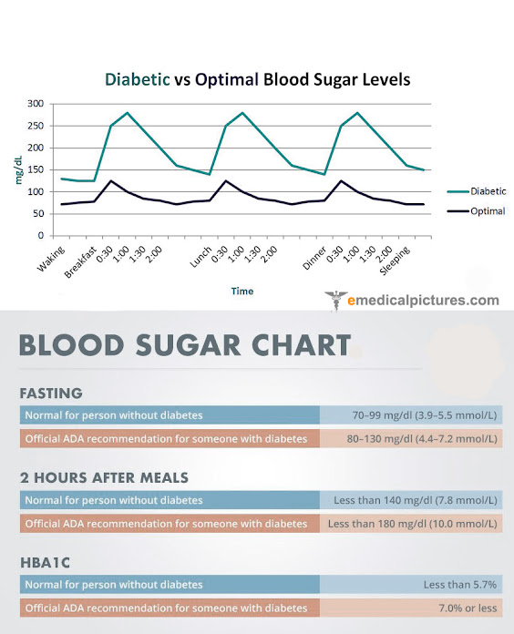 Normal blood sugar levels chart (comparison with diabetes) | Medical ...