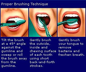 Proper Brushing