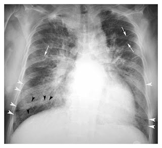 PULSEOFMEDICO: KERLEY LINES