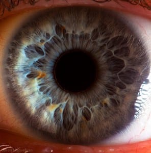 eye5