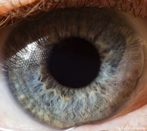 eye6